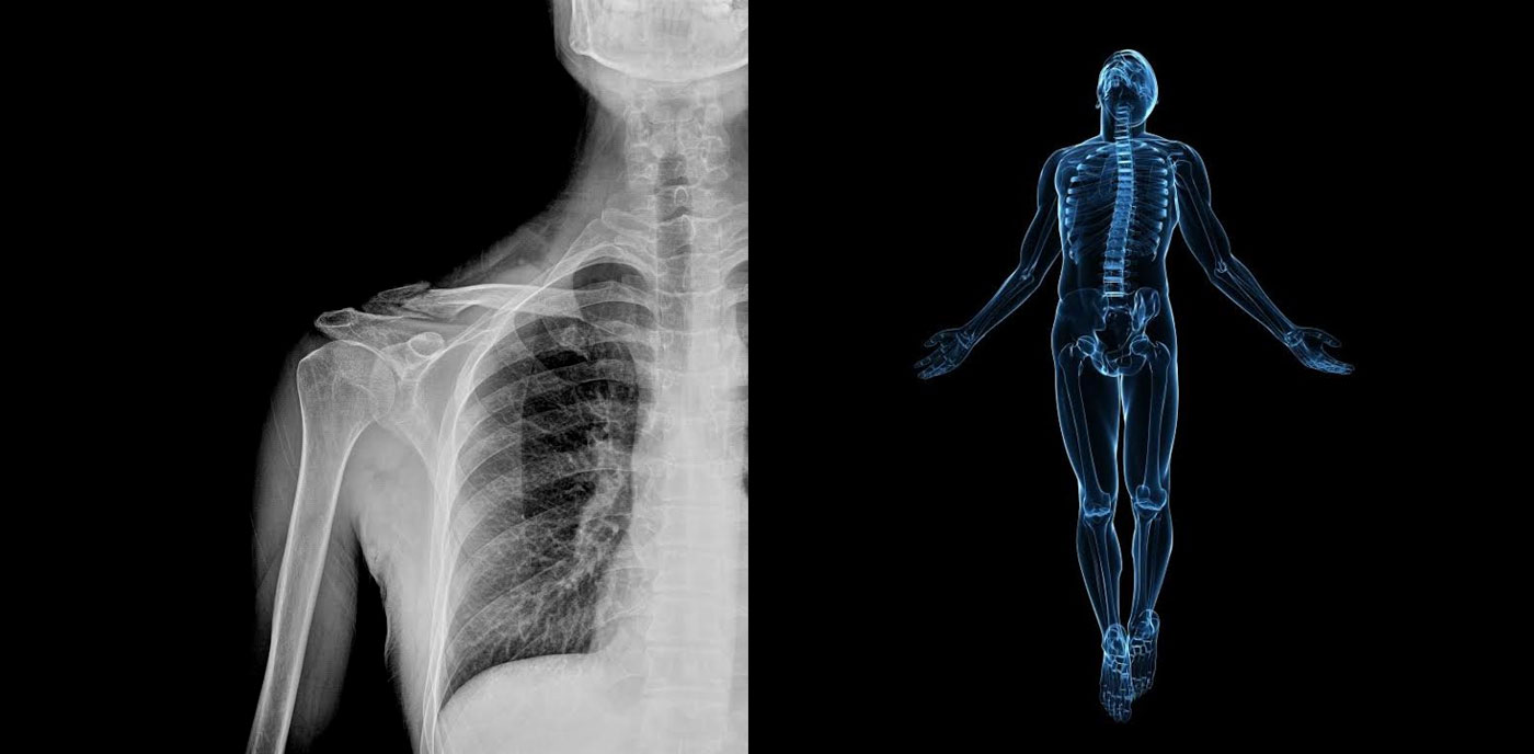 ai-doctors-diagnose-x-rays.jpg